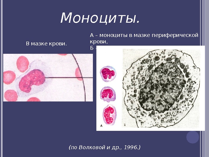 В мазке крови. А – моноциты в мазке периферической крови,  Б – ТЭМ.