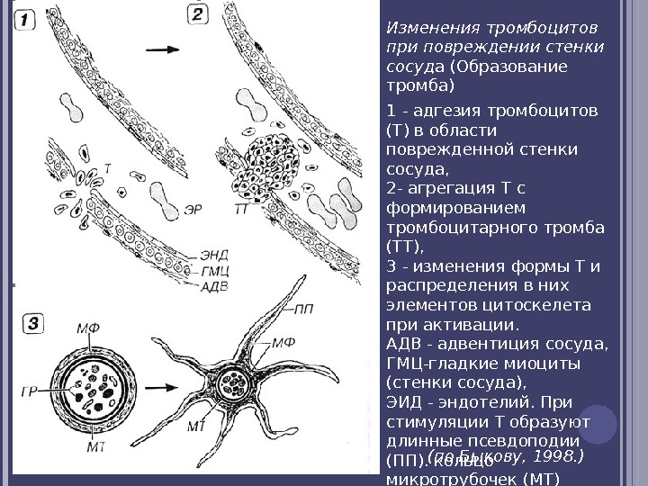 Изменения тромбоцитов при повреждении стенки сосуд а (Образование тромба) 1 - адгезия тромбоцитов (Т)