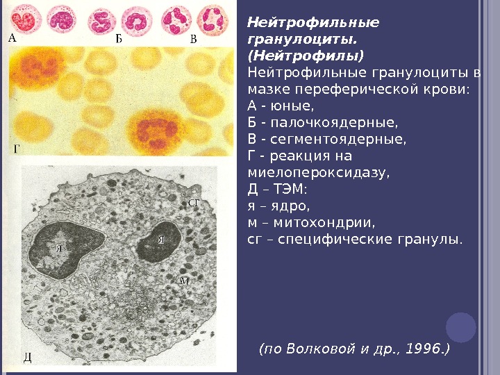 Нейтрофильные гранулоциты. (Нейтрофилы) Нейтрофильные гранулоциты в мазке переферической крови:  А - юные, 