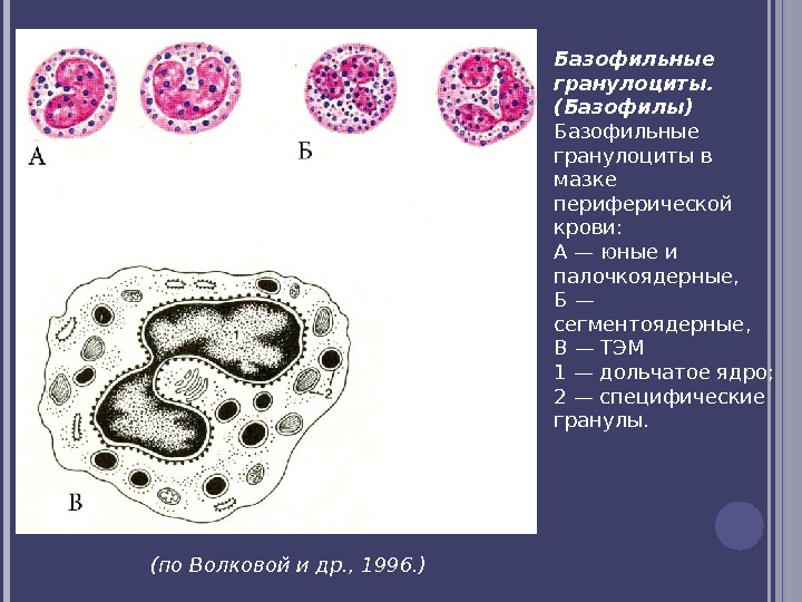 Базофильные гранулоциты. (Базофилы) Базофильные гранулоциты в мазке периферической крови:  А — юные и