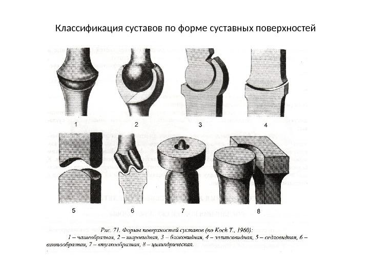 Классификация суставов по форме суставных поверхностей 