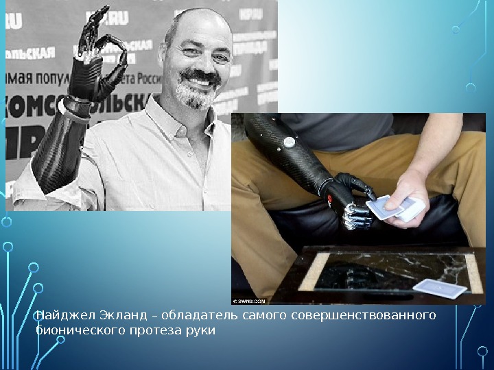 Найджел Экланд – обладатель самого совершенствованного бионического протеза руки 