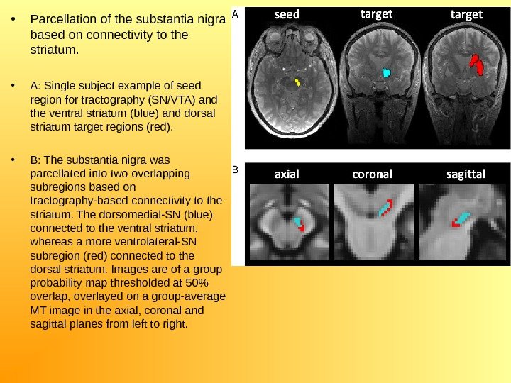  • Parcellation of the substantia nigra based on connectivity to the striatum. 