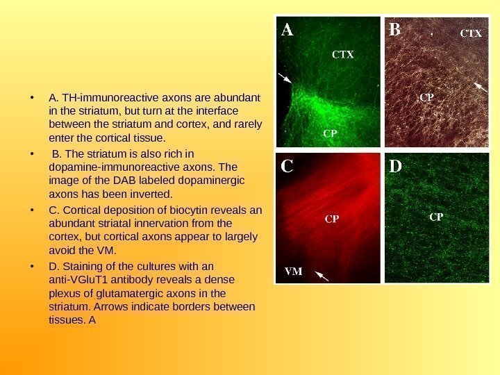  • A. TH-immunoreactive axons are abundant in the striatum, but turn at the