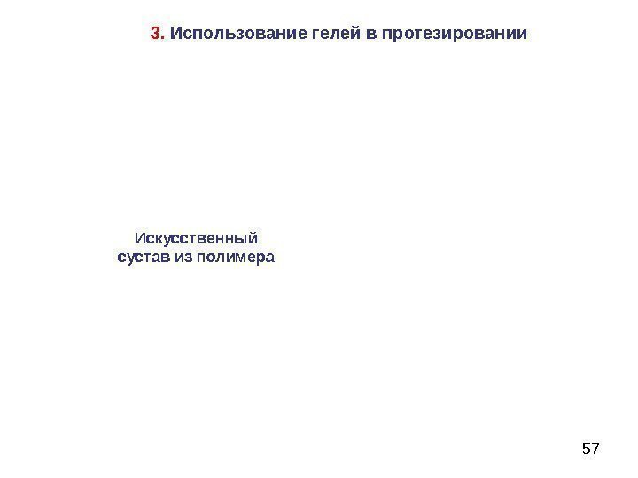   573.  Использование гелей в протезировании Искусственный сустав из полимера 