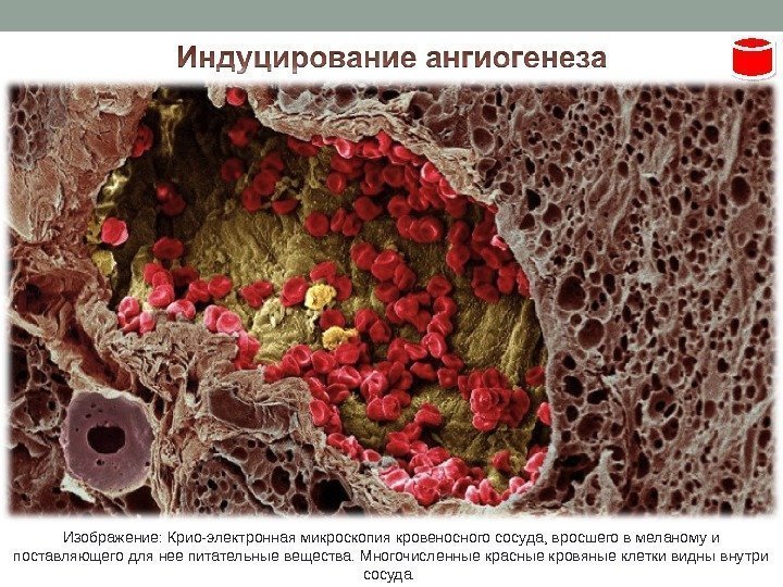 Изображение: Крио-электронная микроскопия кровеносного сосуда, вросшего в меланому и поставляющего для нее питательные вещества.