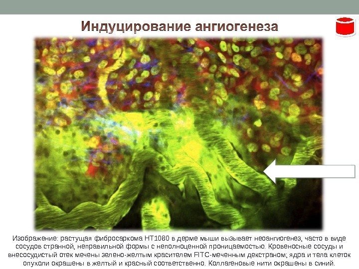 Изображение: растущая фибросаркома HT 1080 в дерме мыши вызывает неоангиогенез, часто в виде сосудов