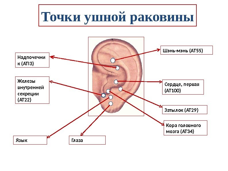 Точки ушной раковины Шэнь-мэнь (АТ 55)  Сердце, первая ( AT 100) Затылок (