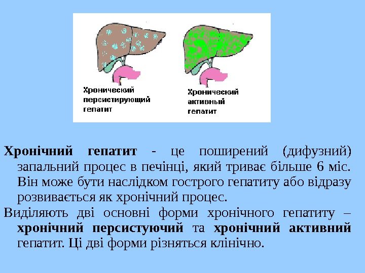   Хронічний гепатит  - це поширений (дифузний) запальний процес в печінці, 