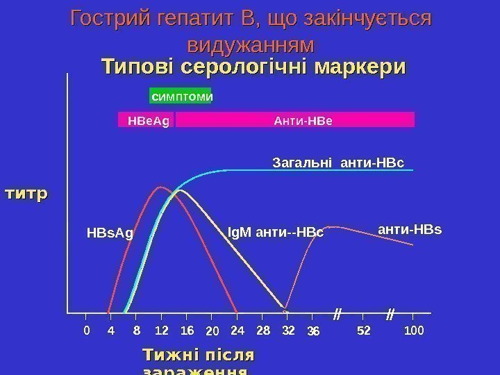   Гострий гепатит В, що закінчується видужанням Типові серологічні маркери Тижні після 