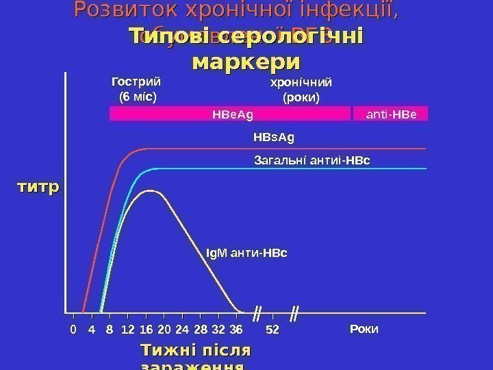   Розвиток хронічної інфекції,  обумовленої ВГВ титр Ig. M анти -HBc. Загальні