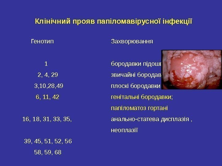   Клінічний прояв папіломавірусної інфекції  Генотип Захворювання    1 бородавки