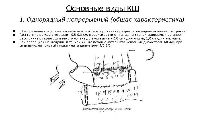 Основные виды КШ 1. Однорядный непрерывный (общая характеристика) ● Шов применяется для наложения анастомозов