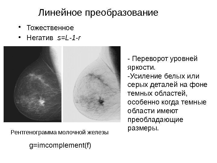 Линейное преобразование • Тожественное • Негатив  s=L-1 -r Рентгенограмма молочной железы - Переворот