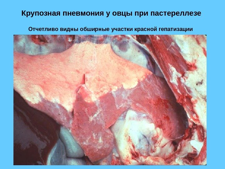 Крупозная пневмония у овцы при пастереллезе Отчетливо видны обширные участки красной гепатизации  