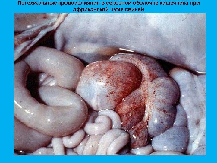 Петехиальные кровоизлияния в серозной оболочке кишечника при африканской чуме свиней 