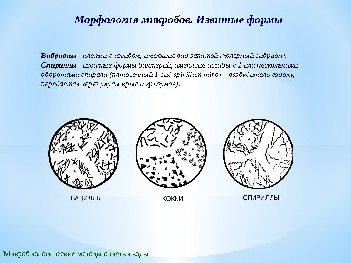 Морфология микробов. Извитые формы Микробиологические методы очистки воды Вибрионы - клетки с изгибом, имеющие