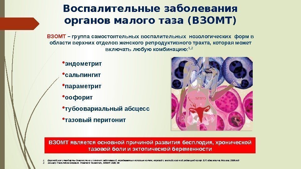 Воспалительные заболевания органов малого таза (ВЗОМТ) 1. Европейские стандарты диагностики и лечения заболеваний, передаваемых
