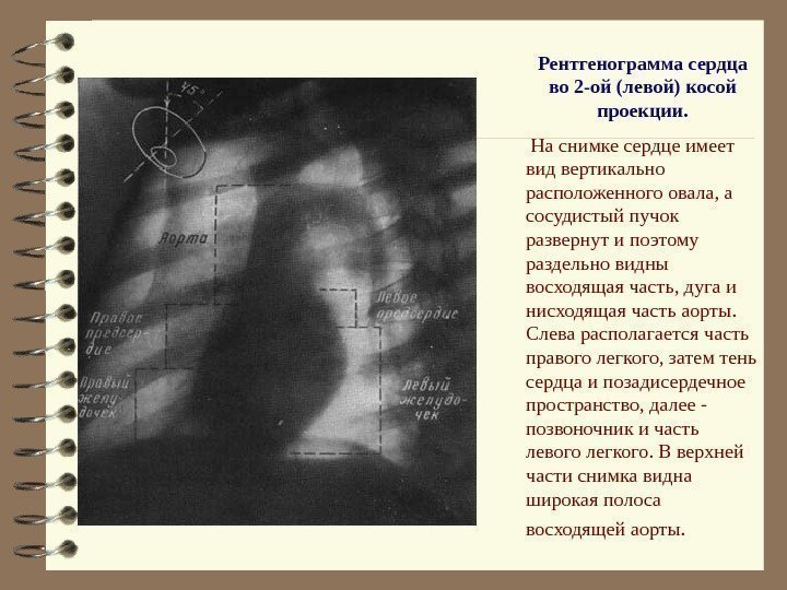   Рентгенограмма сердца во 2 -ой (левой) косой проекции.  На снимке сердце