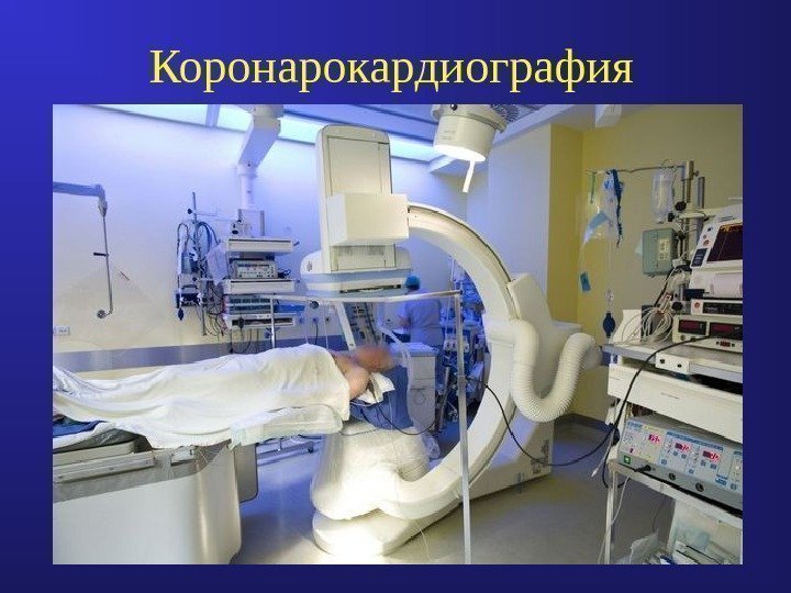 Коронарокардиография  