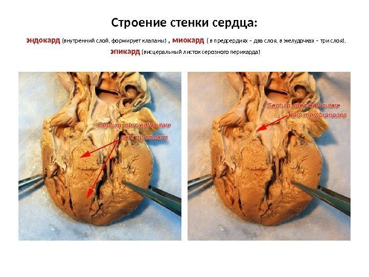 Строение стенки сердца:  эндокард (внутренний слой, формирует клапаны) ,  миокард ( в