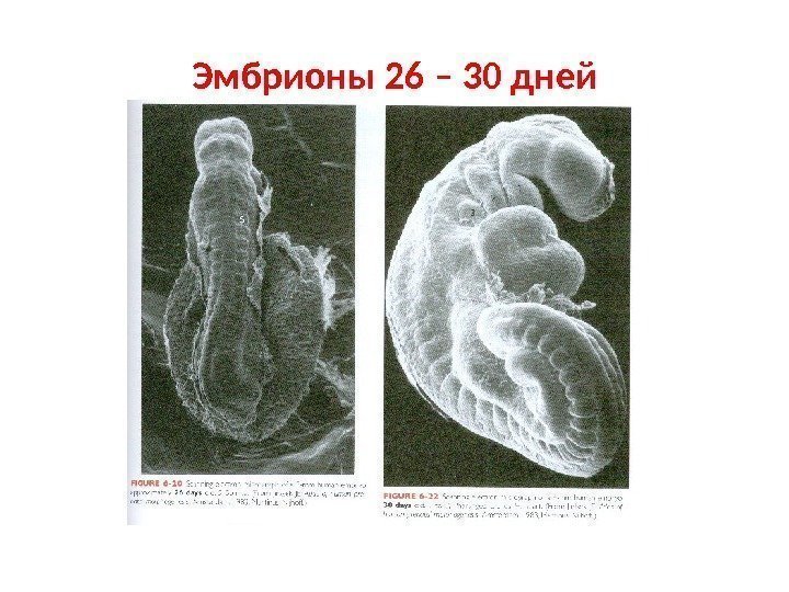 Эмбрионы 26 – 30 дней 