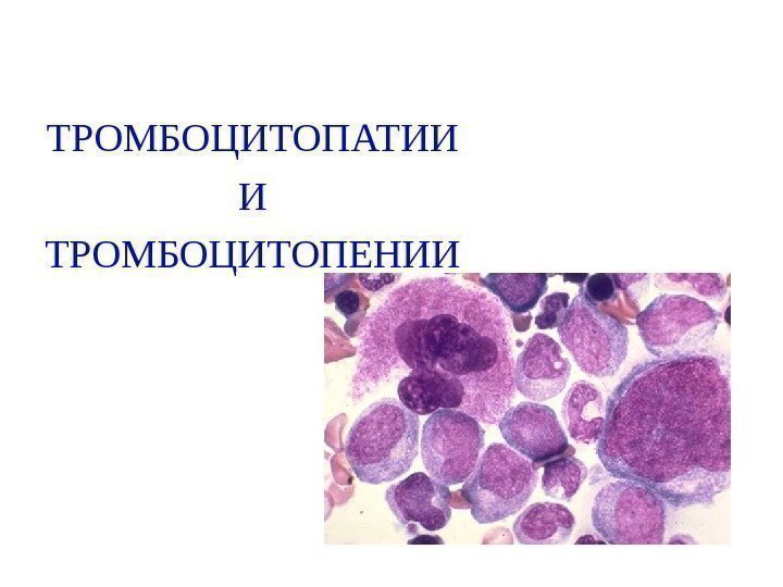  ТРОМБОЦИТОПАТИИ И ТРОМБОЦИТОПЕНИИ      