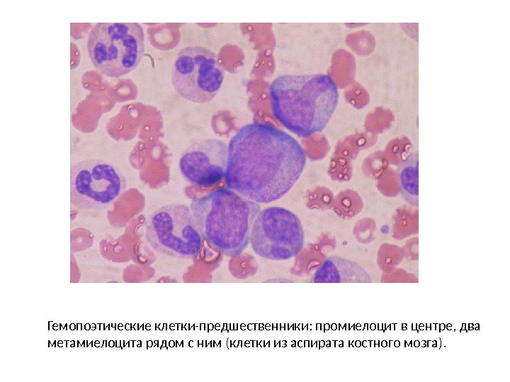 Гемопоэтические клетки-предшественники: промиелоцит в центре, два метамиелоцита рядом с ним (клетки из аспирата костного