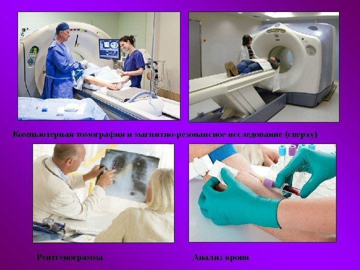   Компьютерная томография и магнитно-резонансное исследование (сверху) Рентгенограмма Анализ крови 
