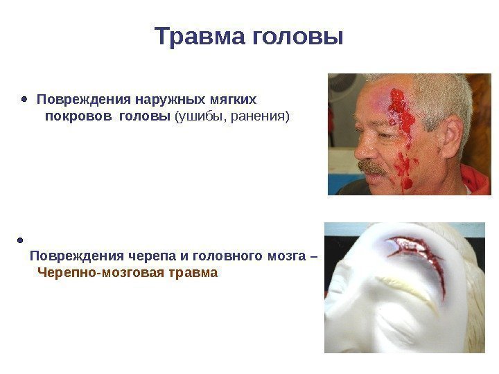   Травма головы Повреждения наружных мягких покровов головы (ушибы, ранения)  Повреждения черепа