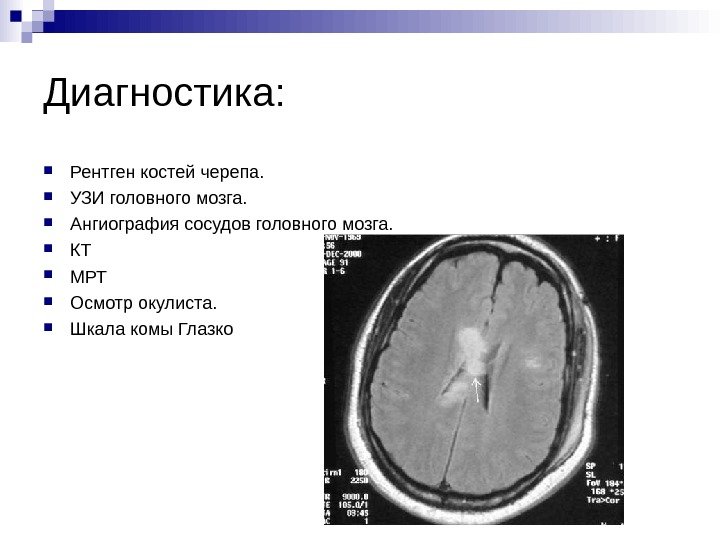  Диагностика:  Рентген костей черепа.  УЗИ головного мозга.  Ангиография сосудов