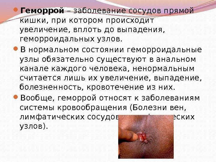  Геморрой – заболевание сосудов прямой кишки, при котором происходит увеличение, вплоть до выпадения,