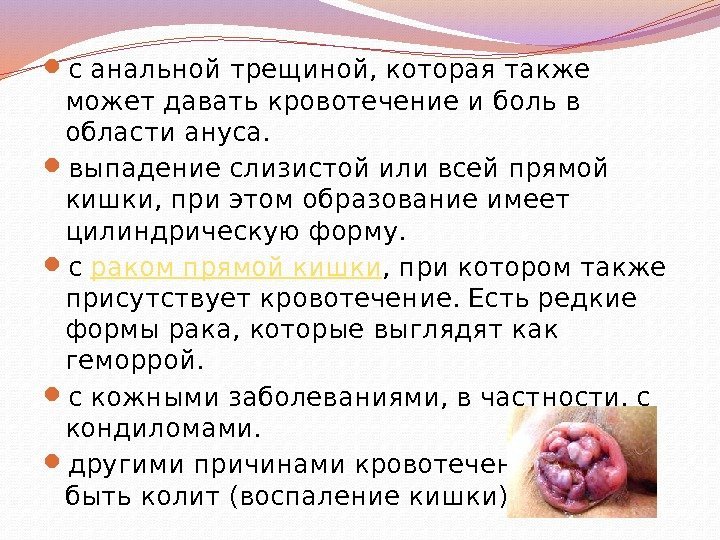  с анальной трещиной, которая также может давать кровотечение и боль в области ануса.