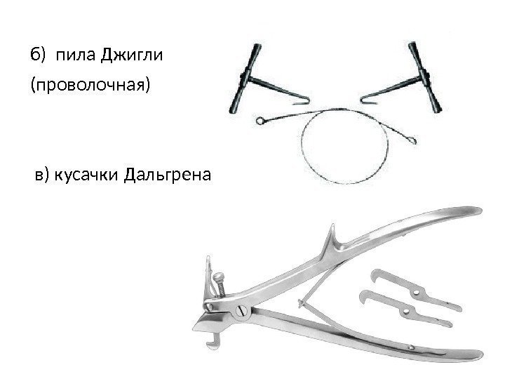 б) пила Джигли (проволочная)  в) кусачки Дальгрена 