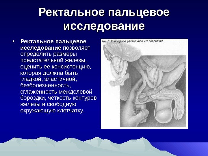 Ректальное пальцевое исследование • Ректальное пальцевое исследование позволяет определить размеры предстательной железы,  оценить