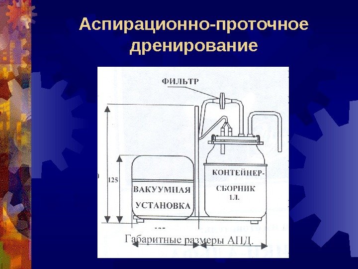 Аспирационно-проточное дренирование 