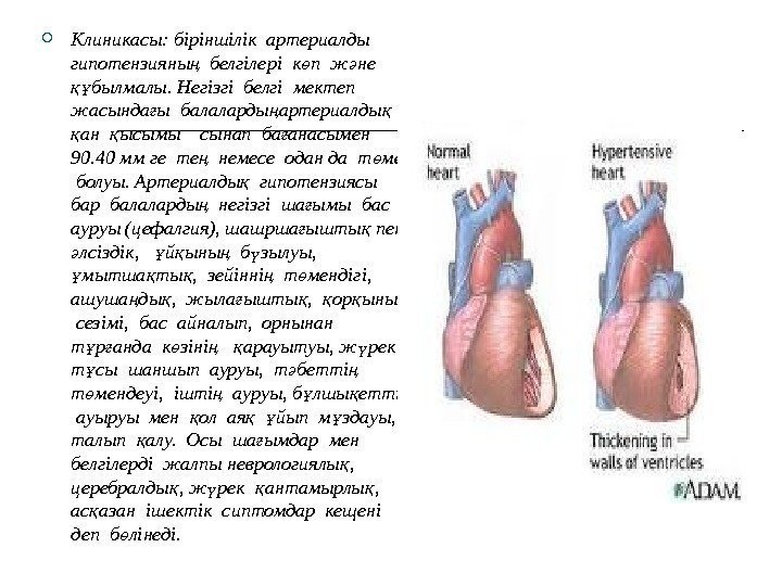  Клиникасы: біріншілік артериалды гипотензияны  белгілері к п ж не ң ө ә