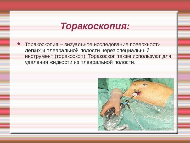 Торакоскопия:  Торакоскопия – визуальное исследование поверхности легких и плевральной полости через специальный инструмент
