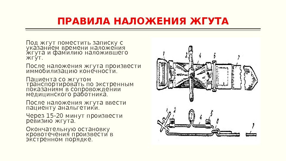 ПРАВИЛА НАЛОЖЕНИЯ ЖГУТА Под жгут поместить записку с указанием времени наложения жгута и фамилию