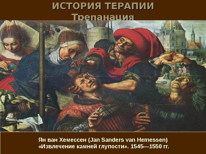 ИСТОРИЯ ТЕРАПИИ Трепанация Ян ван Хемессен (Jan Sanders van Hemessen)  «Извлечение камней глупости»