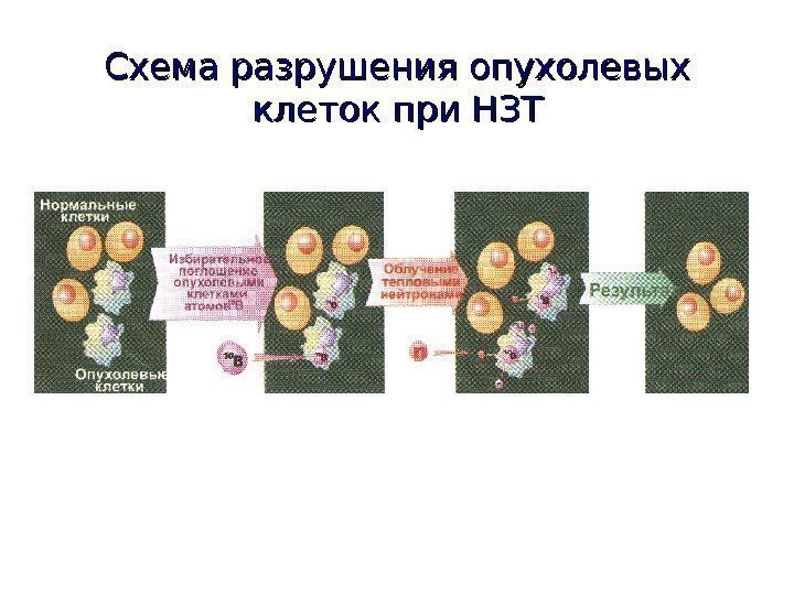   Схема разрушения опухолевых клеток при НЗТ 
