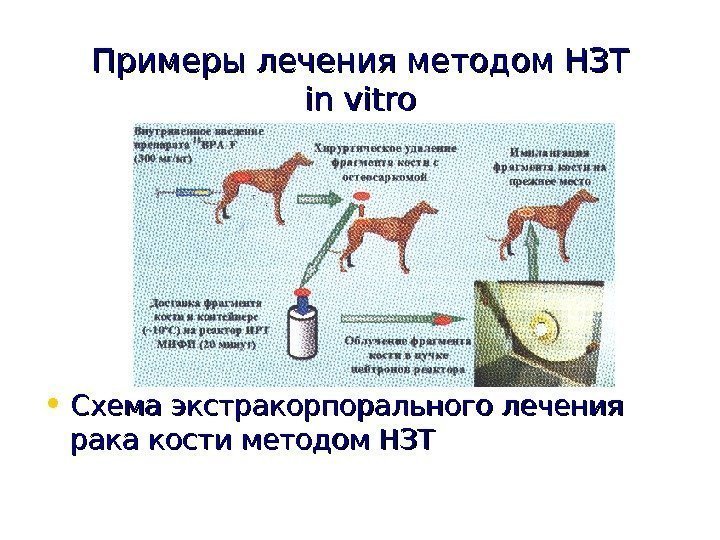   Примеры лечения методом НЗТ in vitro • Схема экстракорпорального лечения  рака