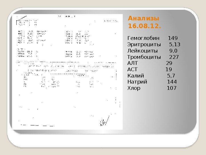 Анализы 16. 08. 12. Гемоглобин 149 Эритроциты 5, 13 Лейкоциты  9, 0 Тромбоциты