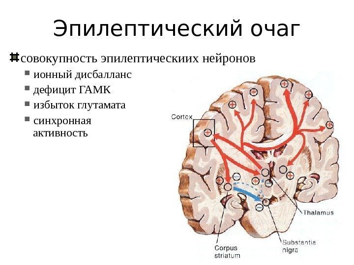 Эпилептический очаг совокупность эпилептическиих нейронов ионный дисбалланс дефицит ГАМК избыток глутамата синхронная активность 