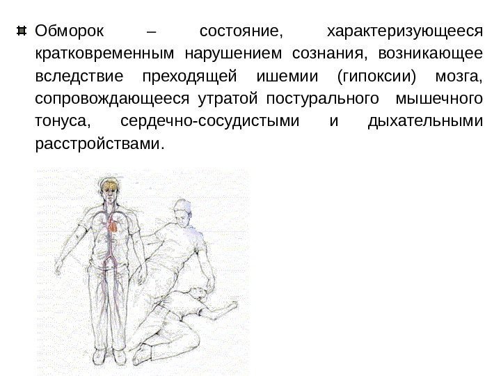 Обморок – состояние,  характеризующееся кратковременным нарушением сознания,  возникающее вследствие преходящей ишемии (гипоксии)