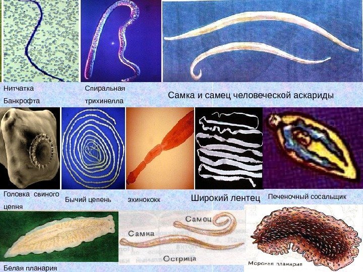 Нитчатка Банкрофта Спиральная трихинелла Печеночный сосальщик Бычий цепень эхинококк. Головка свиного цепня Белая планария