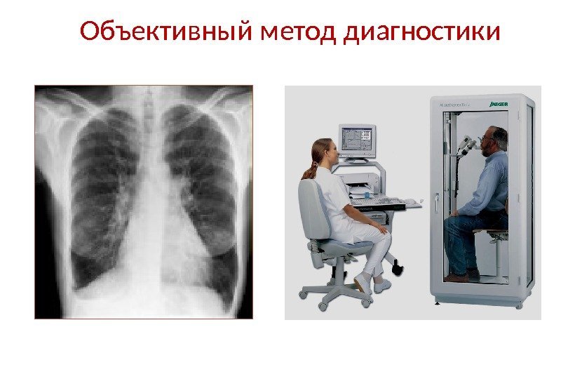 Объективный метод диагностики Рентгенография органов  грудной клетки Спирометрия 