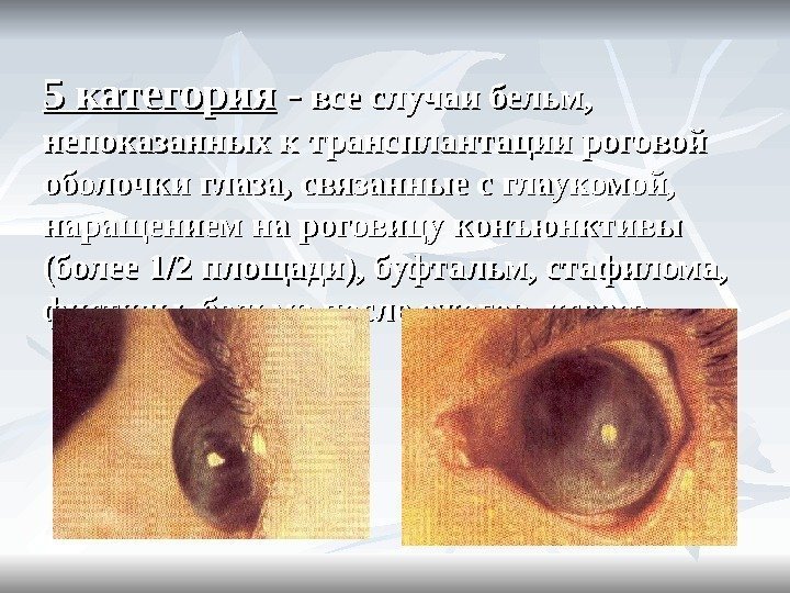 5 категория - - все случаи бельм,  непоказанных к трансплантации роговой оболочки глаза,