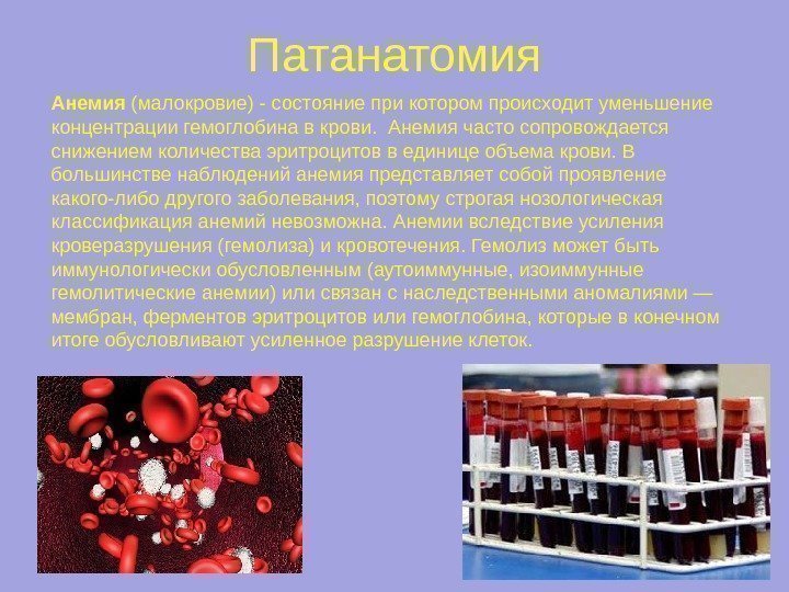 Патанатомия Анемия (малокровие) - состояние при котором происходит уменьшение концентрации гемоглобина в крови. 