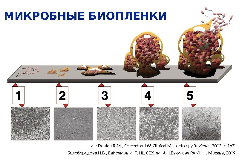 Из: Donlan R. M. , Costerton J. W. Clinical Microbiology Reviews; 2002. p. 167